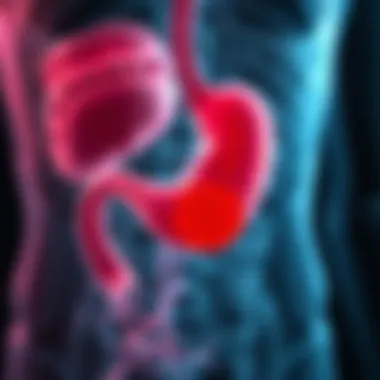 Stomach Anatomy Affected by H. pylori Illustration of the stomach anatomy affected by H. pylori
