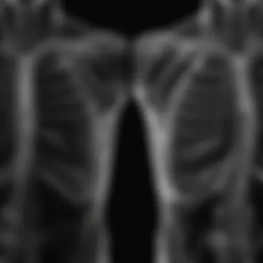 Side-by-side comparison of normal and abnormal chest X-ray findings