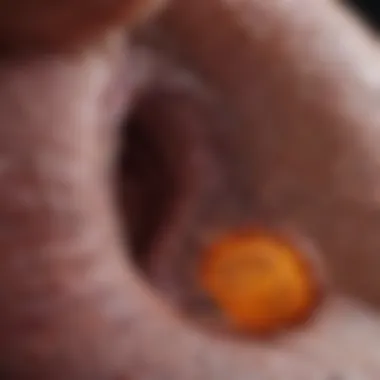 Identifying Symptoms of Pancreatic Cancer Symptoms of pancreatic cancer chart