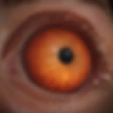 Stages of Diabetic Retinopathy Visual representation of diabetic retinopathy stages
