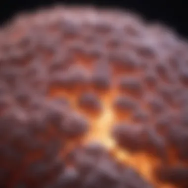 Progression of Small Cell Lung Cancer Overview of small cell lung cancer progression