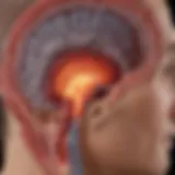 Diagram illustrating the pathophysiology of hemorrhagic stroke