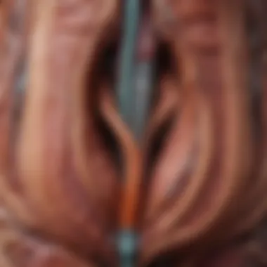 Bladder Anatomy in Interstitial Cystitis Visualization of the bladder anatomy highlighting interstitial cystitis