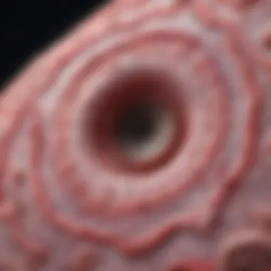 Histopathology of Rosai-Dorfman Disease Histological section depicting Rosai-Dorfman disease