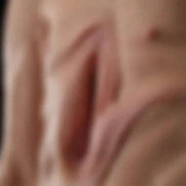 Diagram showing sliding hernia