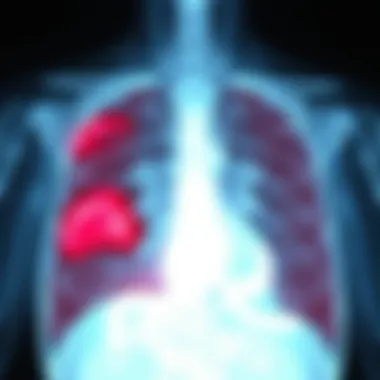 Diagnostic imaging example for hemidiaphragm paralysis