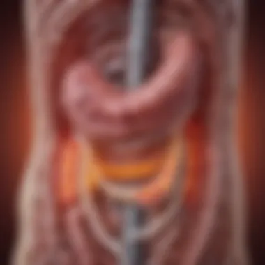 Gastrointestinal Tract and Ulcerative Colitis Visualization of the gastrointestinal tract highlighting ulcerative colitis.
