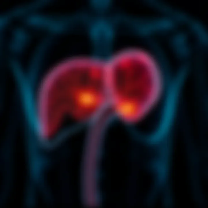 Anatomical Insights into Liver Failure Illustration showing liver anatomy with highlighted areas affected by failure