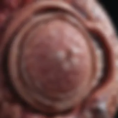 Diagnostic Strategies for Metastatic Adenoma Diagnostic approaches for metastatic adenoma