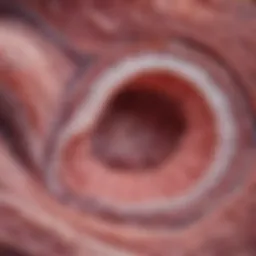 Histological slide demonstrating the distinct features of microscopic collagenous colitis.