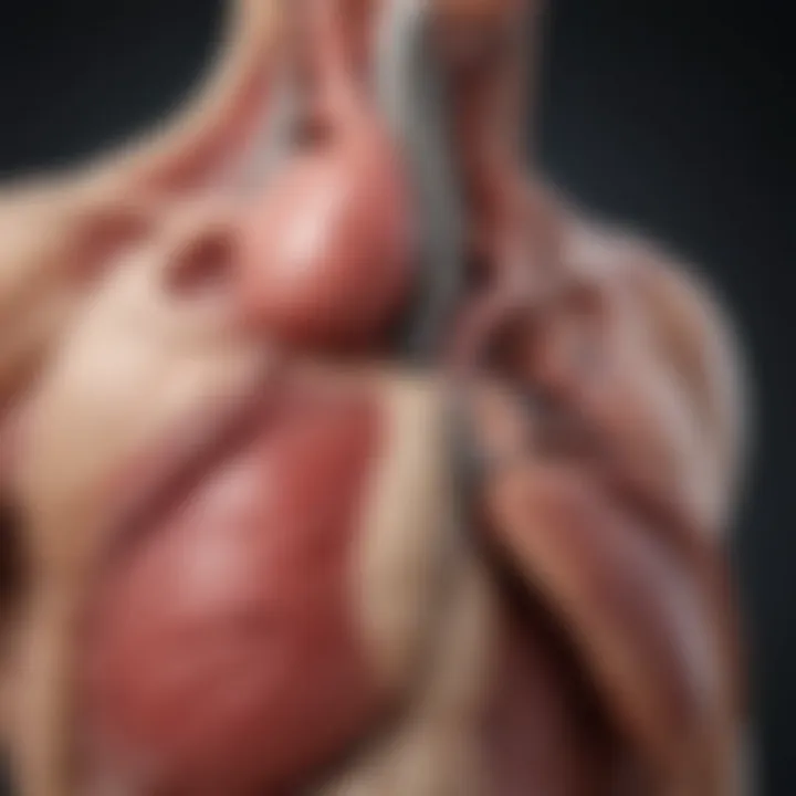 Clinical symptoms associated with Type B aortic dissection