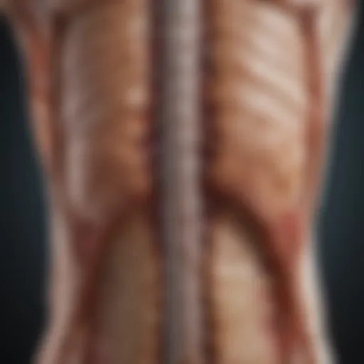Illustration of spinal cord inflammation related to Acute Transverse Myelitis
