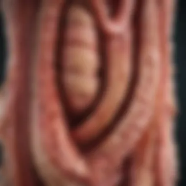 Impact of Celiac Disease on the Small Intestine Illustration of the small intestine affected by celiac disease