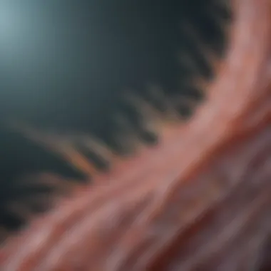 Neuromuscular Junction in Myasthenia Gravis Diagram showing affected neuromuscular junction in myasthenia gravis