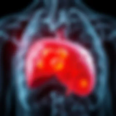 Fat Accumulation in the Liver Illustration depicting liver with fat accumulation