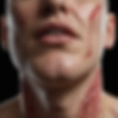 Diagram showing clinical manifestations of RA vasculitis