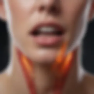 Symptoms of Reflux Laryngitis Diagram showcasing symptoms of reflux laryngitis